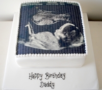 Baby scan birthday cake